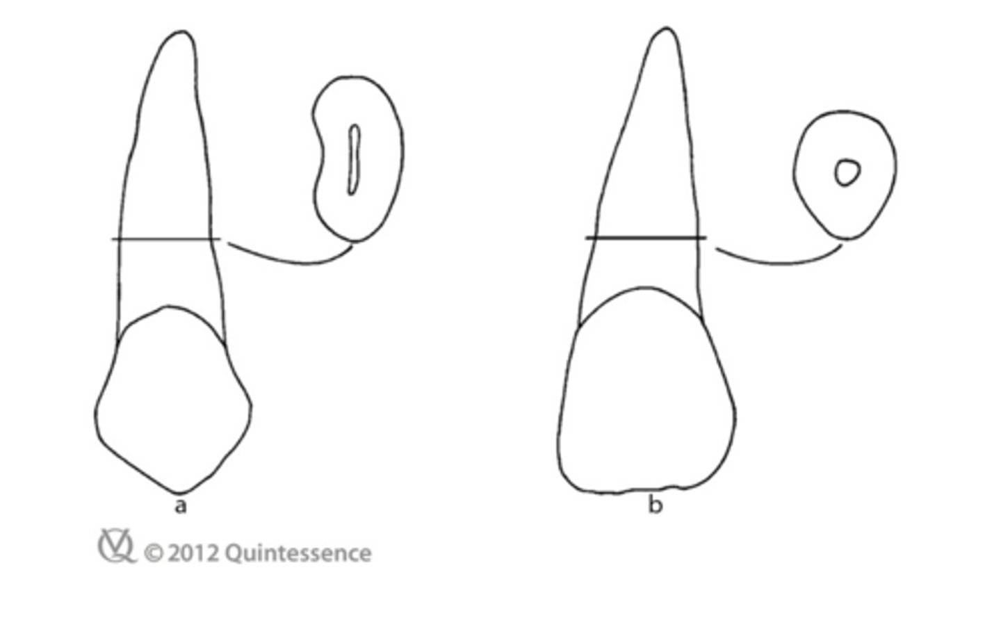 <p>What root configuration is a superior choice for an abutment: A or B?</p>