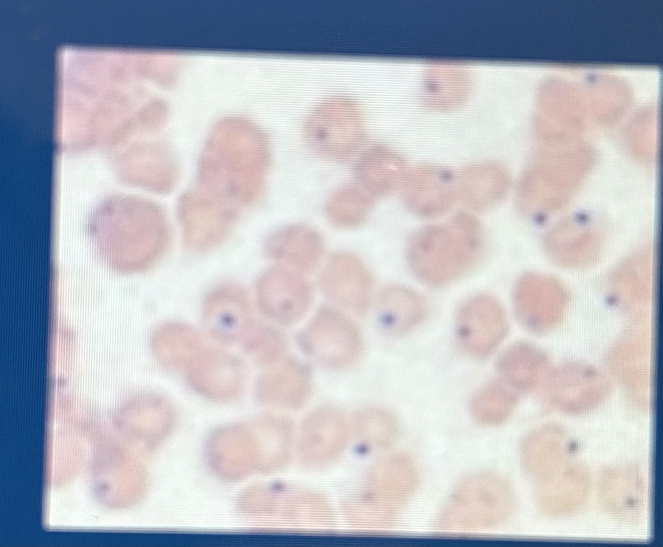 <p>Nuclear remnant single round object, blue stain</p>