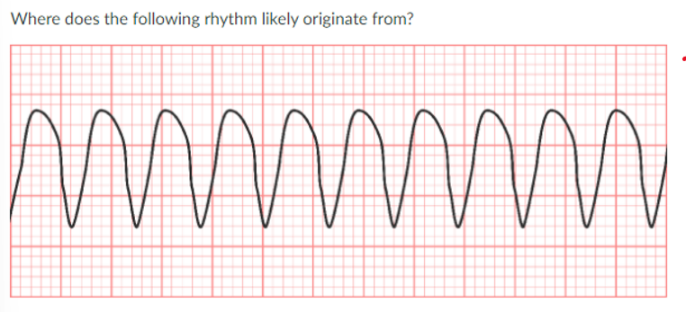 <p>JONES IN CLASS ASSIGNMENT QUESTIONS:</p><p>a. ventricle</p><p>b. atria</p><p>c. SA node</p><p>d. AV node</p>