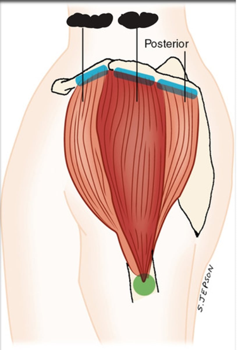 <p>What muscle is this?</p>