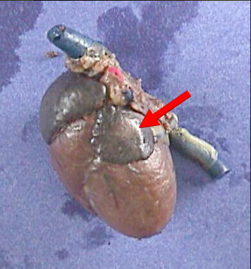 <p>receives oxygen-rich blood and pumps it into left ventricle </p>