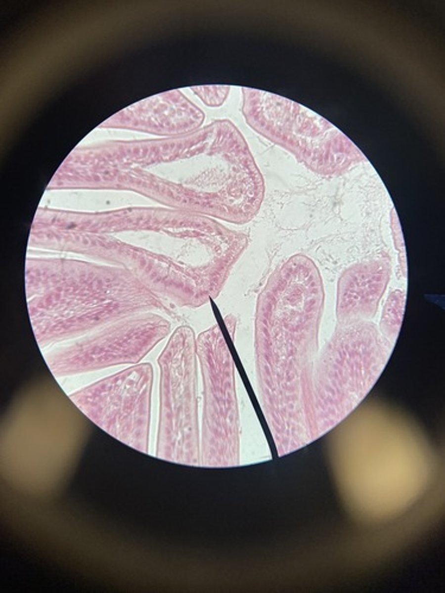 <p>What type of epithelium</p>