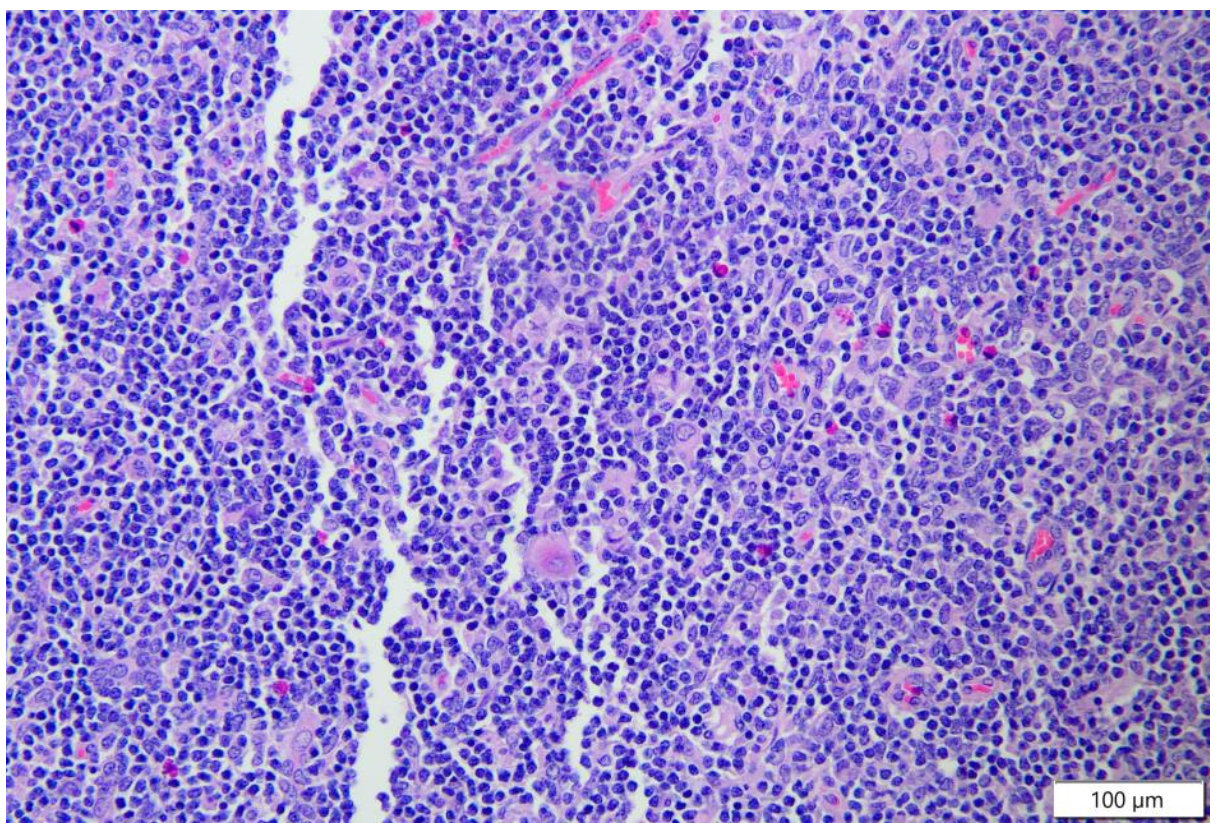 <p>is this thymus normal?</p>