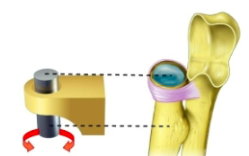 <p>name the specific type of synovial joint </p>