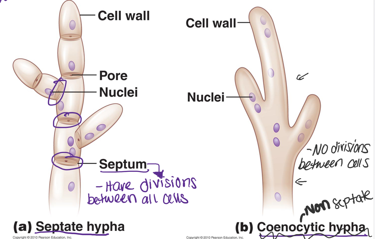 Mold are made of 2 types, long filaments


1. Septate _____= Have Septum, divisions between all cells
2. Coenocytic ____= no divisions between cells