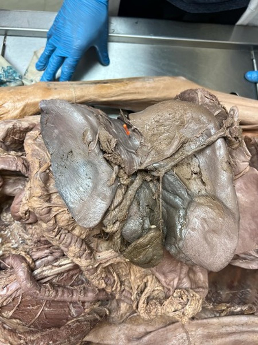 <p>groove for inferior vena cava</p>
