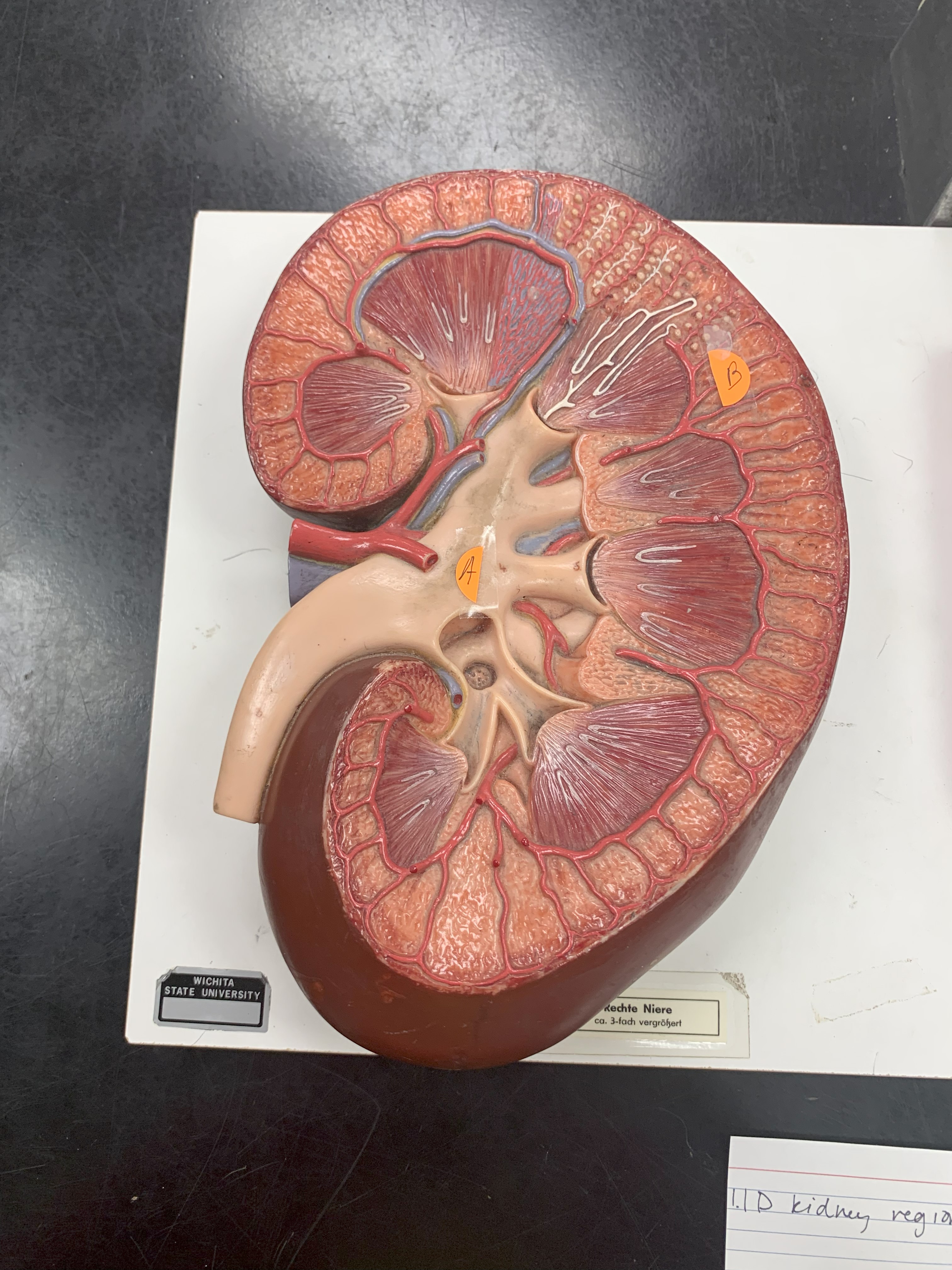 <p>ID kidney region A</p>
