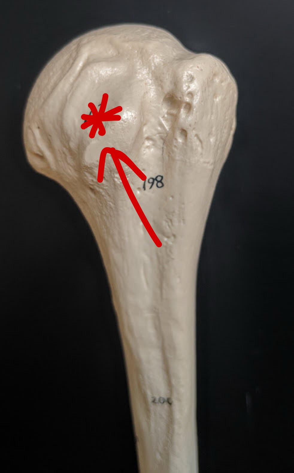 <p>Name this structure</p>