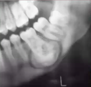 <p>what is the diagnosis?</p>