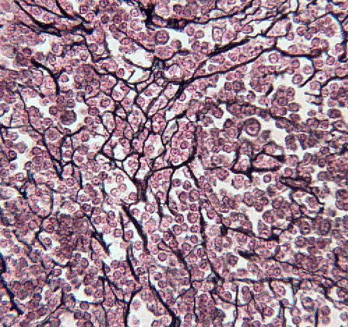 <p>Reticular Tissue</p>