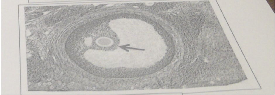 29\. The cells indicated by the arrow