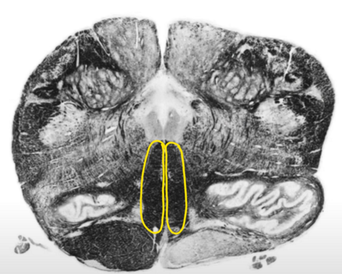 <p>ID the structure</p>