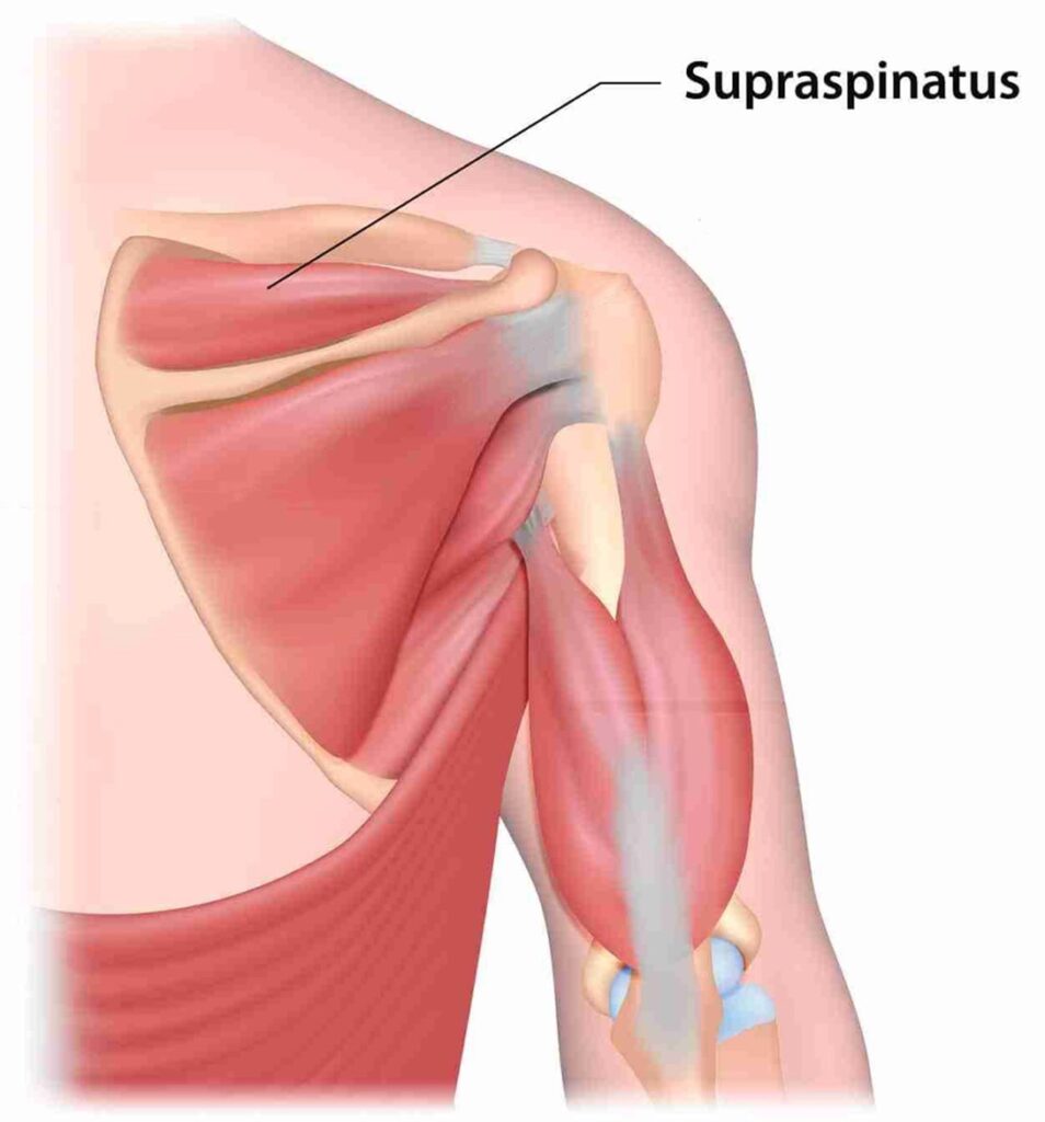 <p>Supraspinatus</p>