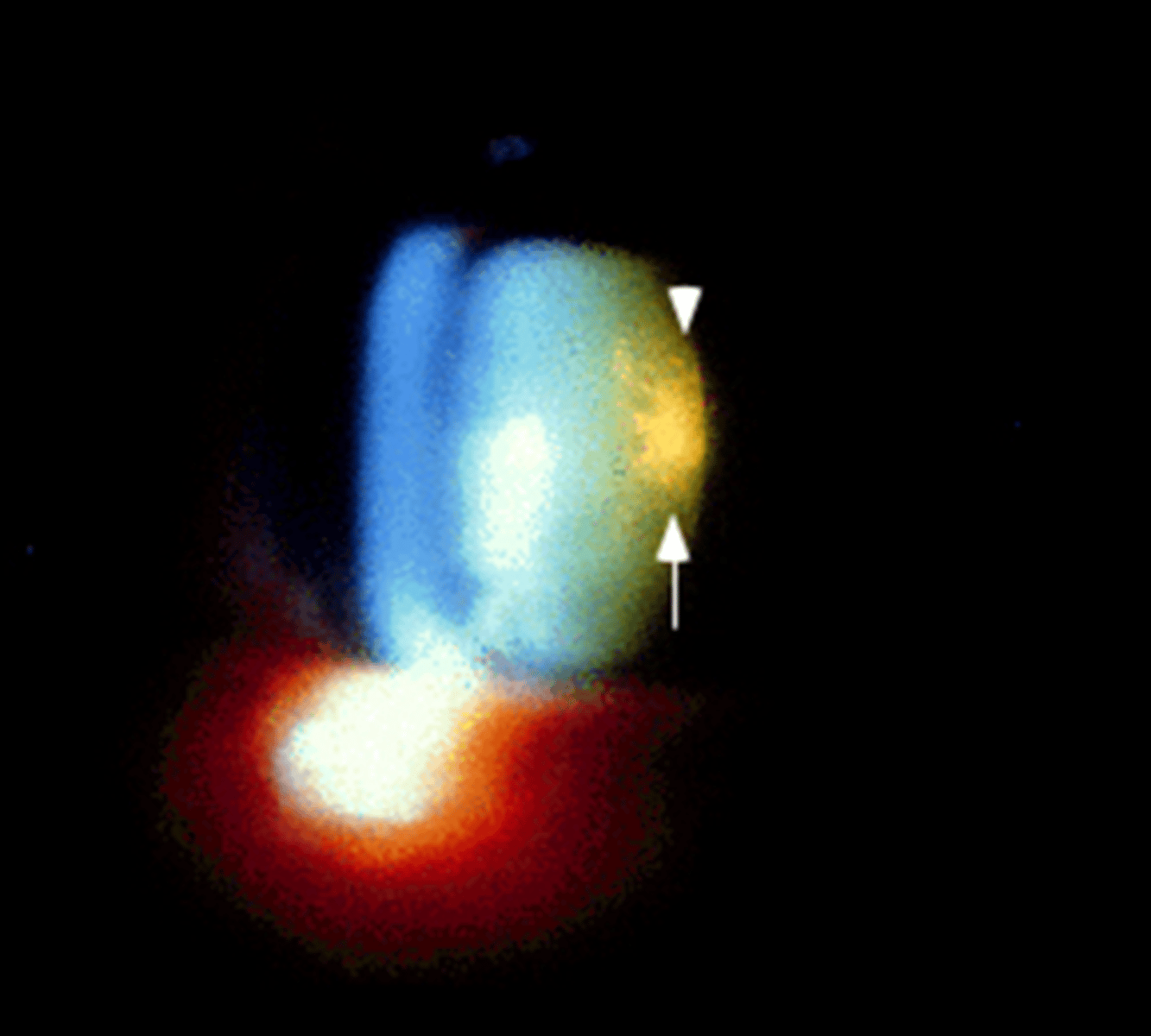 <p>A posterior subcapsular cataract reveals a "frost-like" haze just anterior to the posterior lens capsule which is the back surface of the lens on slit lamp examination</p>