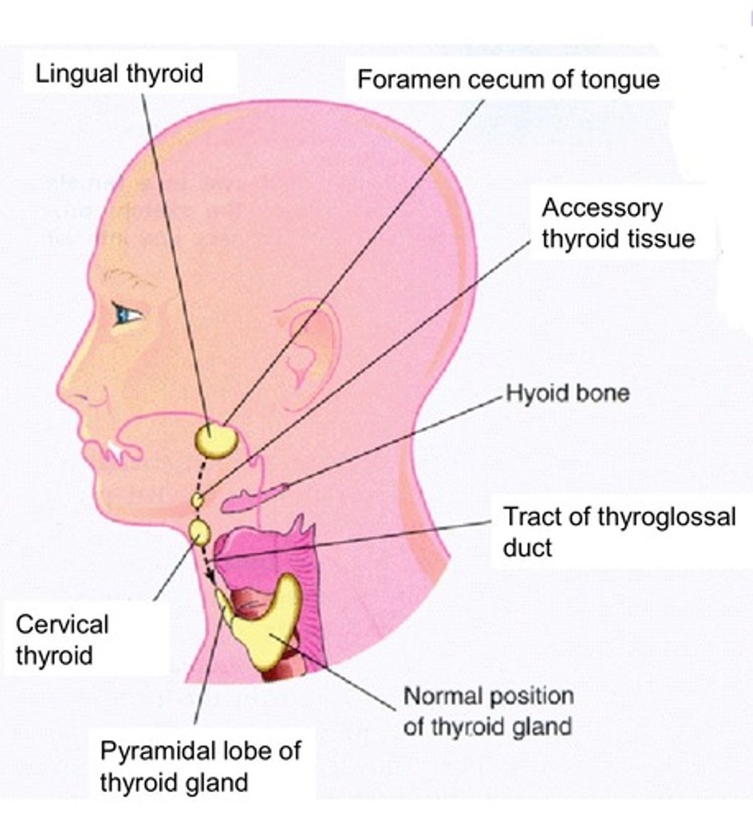 <p>thyroid can leave some tissue behind in its descent pathway anywhere from the tongue to the superior mediastinum<br> ex: lingual thyroid &amp; cervical thyroid</p>
