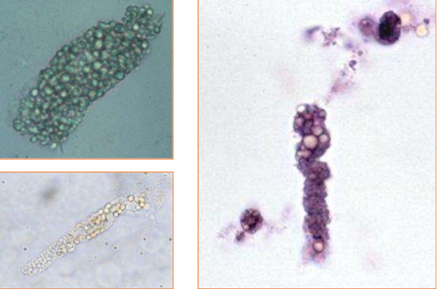 <p>What type of casts are pictured? Are they common or uncommon? What species are they usually seen in?</p>