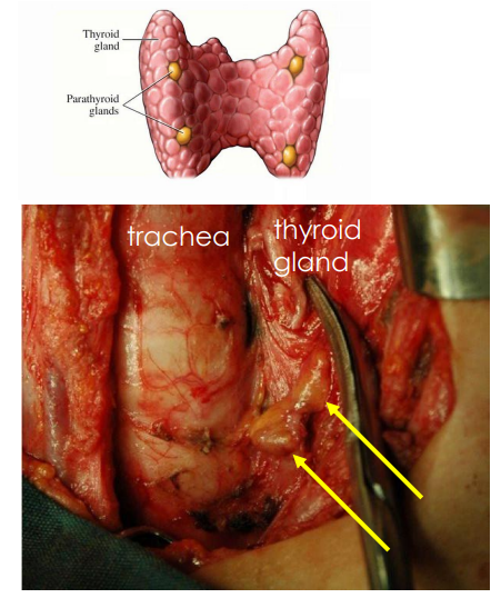 <p>Parathyroid Gland</p>