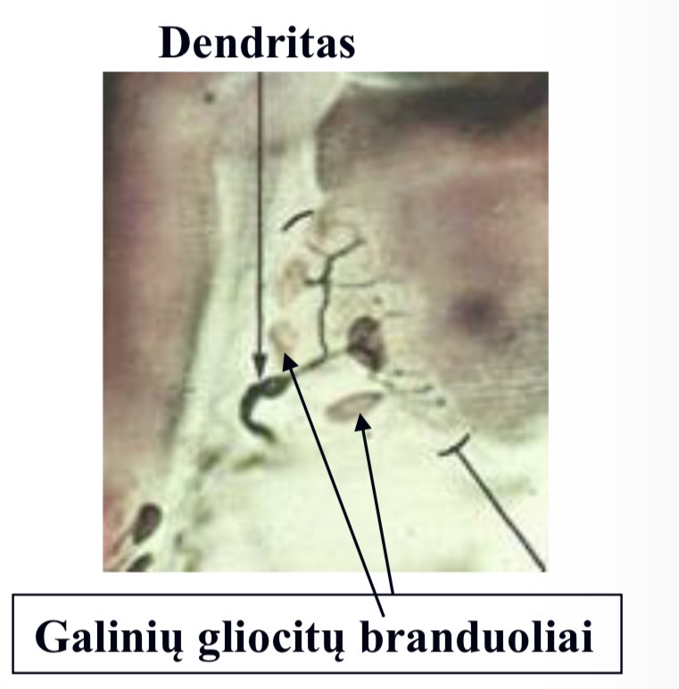 <p>Supa nervinių skaidulų galines šakutes.</p>