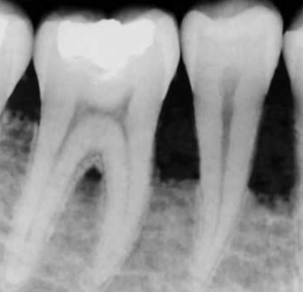 <p>Functions of Alveolar Bone:</p>