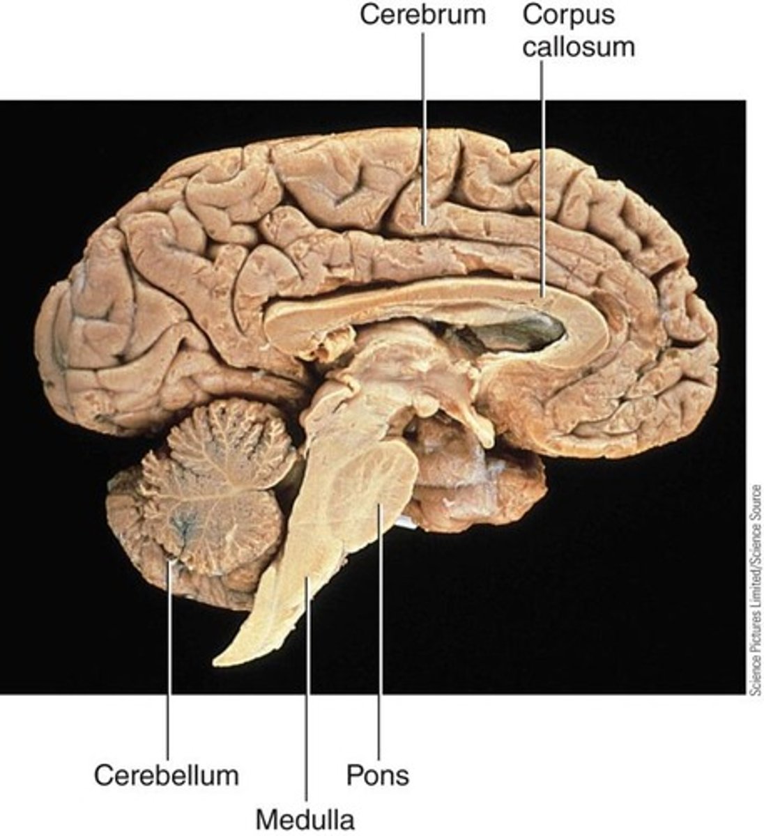 <p>located dorsal to pons and medulla; second largest mass of the brain, involved in hand-eye coordination, balance, and posture</p>