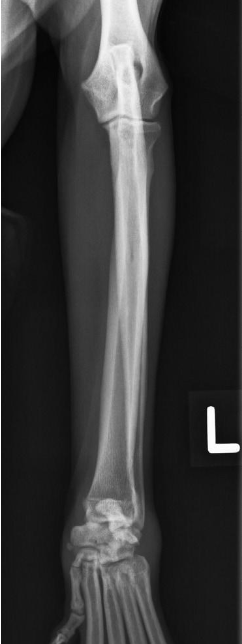<p>what radiograph view of the radius and ulna is shown?</p>