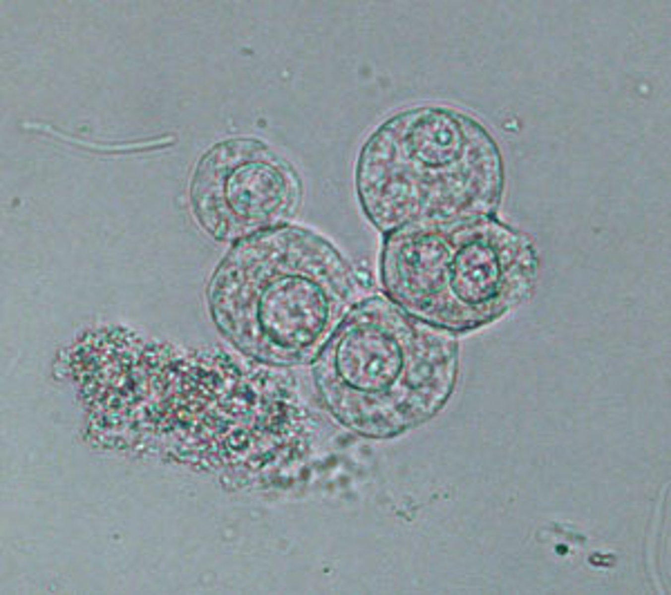 <p>Spherical, polyhedral, or caudate with centrally located nucleus (reported as few, moderate, or many per hpf)</p><p>-correlations= clarity and blood</p>