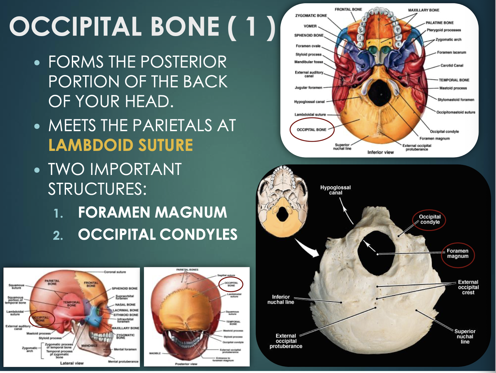 <p>Occipital Bone</p>