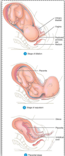 <p>Stages of labour</p>