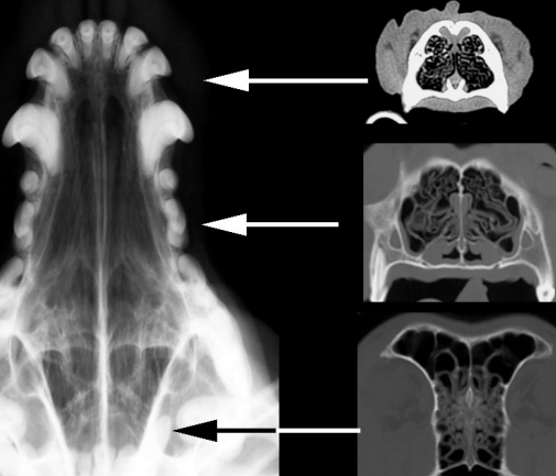 <p>X ray positioning of the head </p>