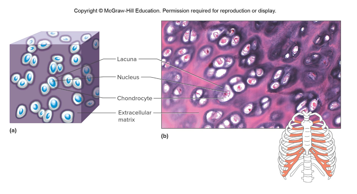 <p>Which cartilage is this </p>