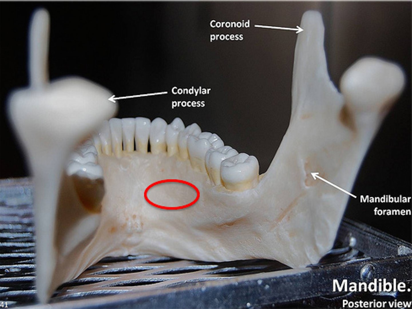 <p>superior to mylohyoid line, occupied by sublingual gland</p>
