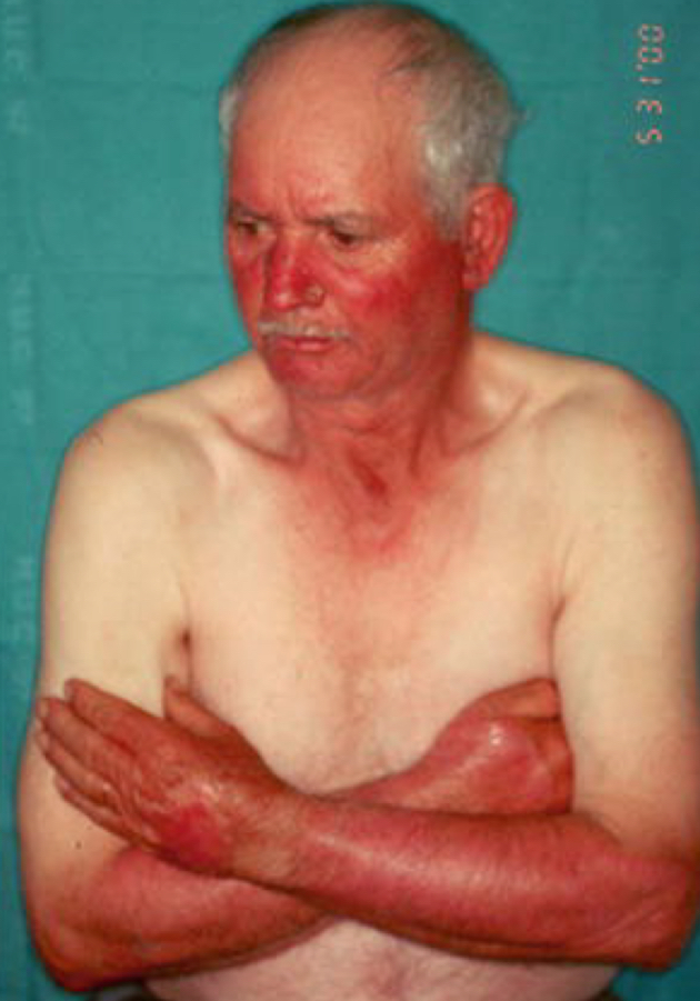 <p>what type of distribution</p>