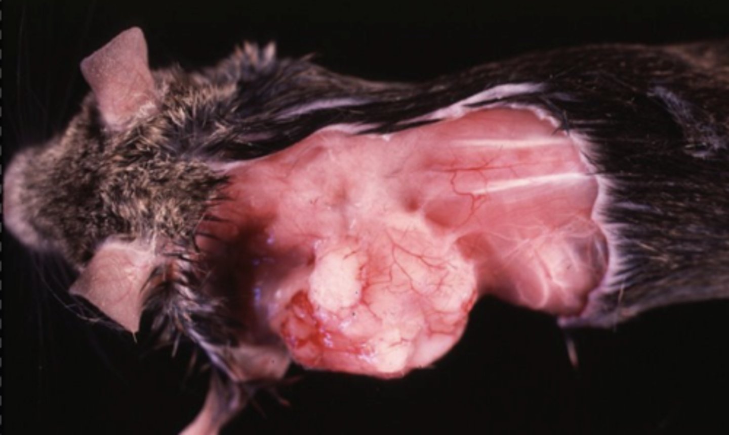 <p>What kind of tumor is this?</p>