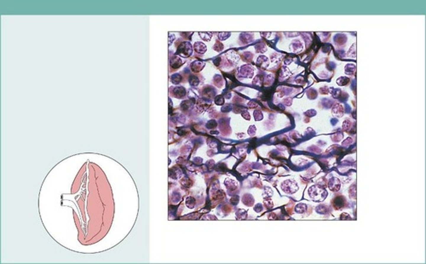 <p>fibers form a soft internal skeleton (stroma) that supports other cell types including white blood cells, mast cells, and macrophages</p>