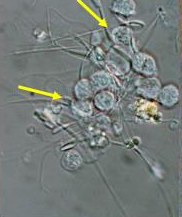 <p>Identify the sperm morphology.</p>