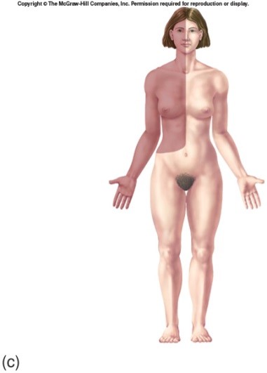 
1. Jugular trunk
2. Subclavian trunk
3. Bronchomediastinal trunk

They typically join a right thoracic vein separately and drain lymph from the right side of the head, right-upper limb, and right thorax.