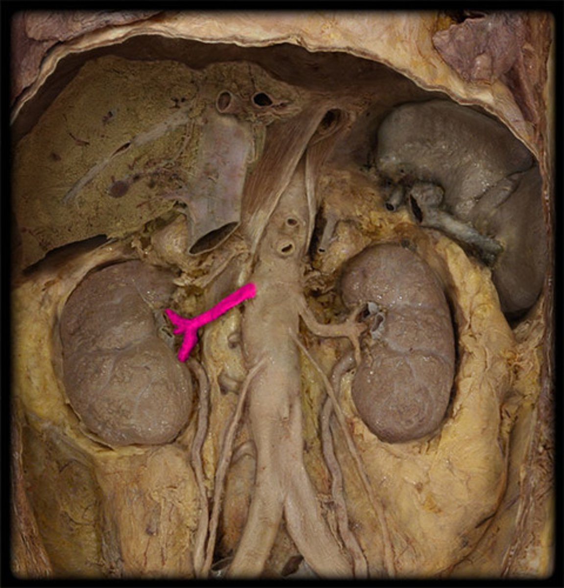 <p>artery</p>