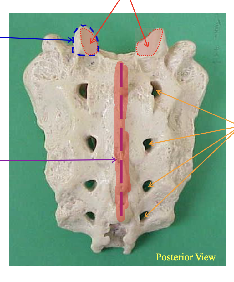 <p>Name the highlighted structure (purple dashed line w/ red highlight)</p>