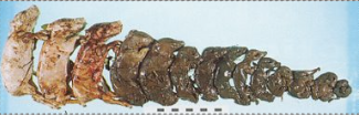 <p>What is the likely cause of this abortion? What is the pathology?</p>