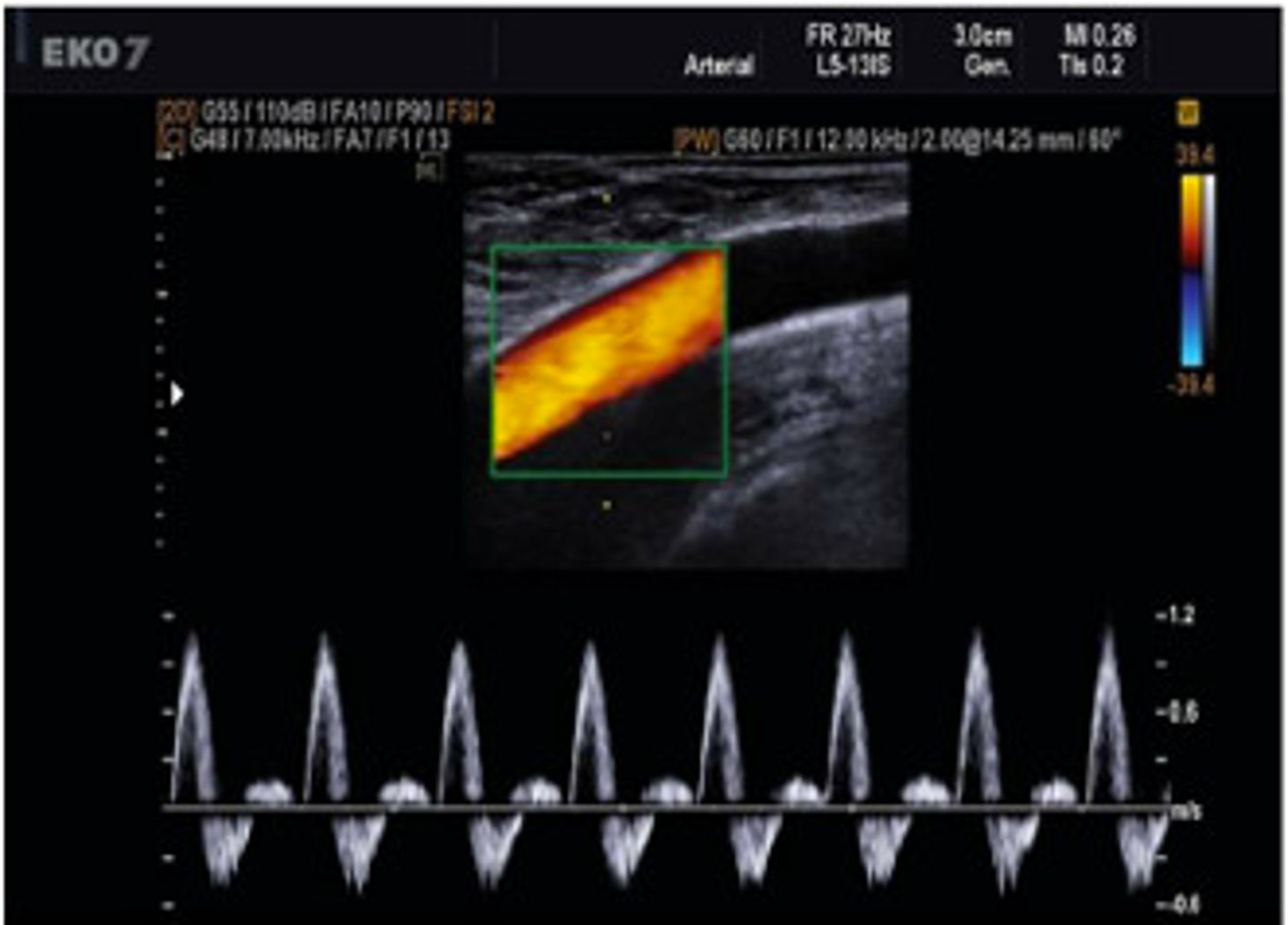 <p>Estimates blood flow velocity</p>