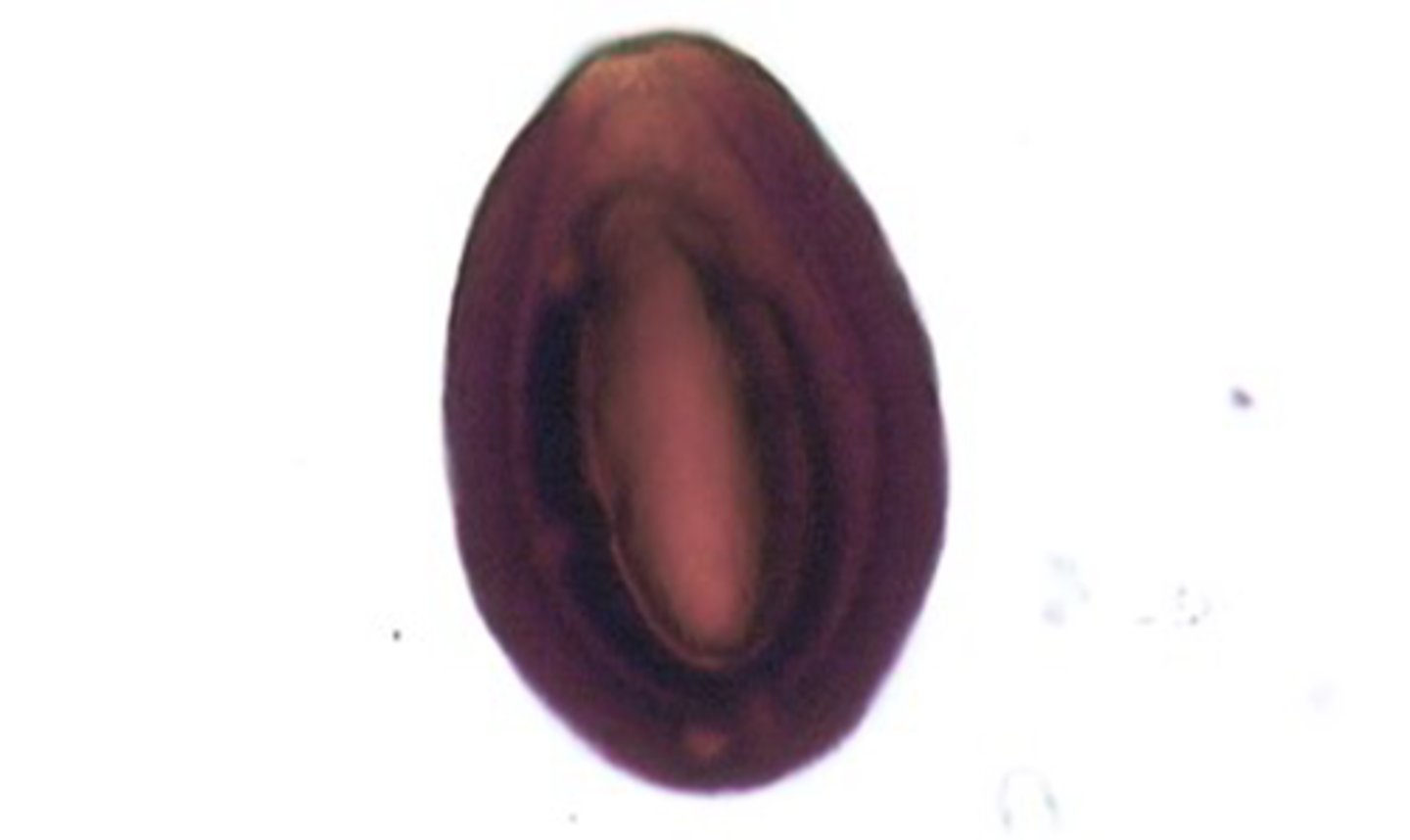 <p>This equine protozoan oocyst is unsporulated and found most commonly in young horses,</p><p>as the host can become immune to the parasite.</p>