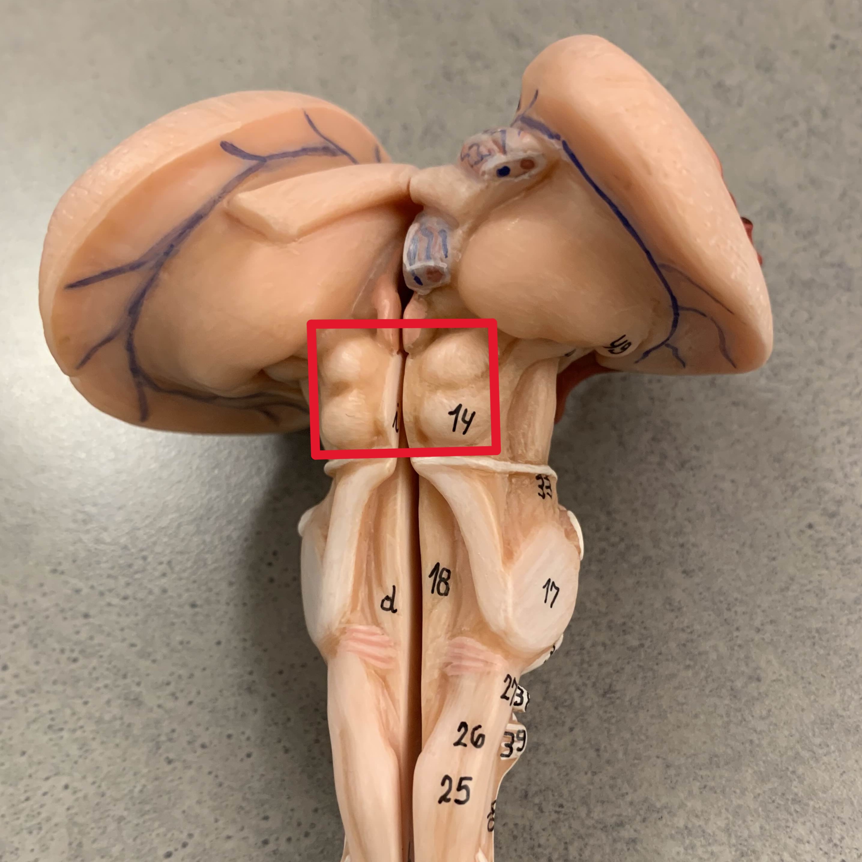<p>Which part of the brain is:</p><ul><li><p>Four bumps on back of midbrain</p></li><li><p>2×2 position</p></li></ul><p></p>