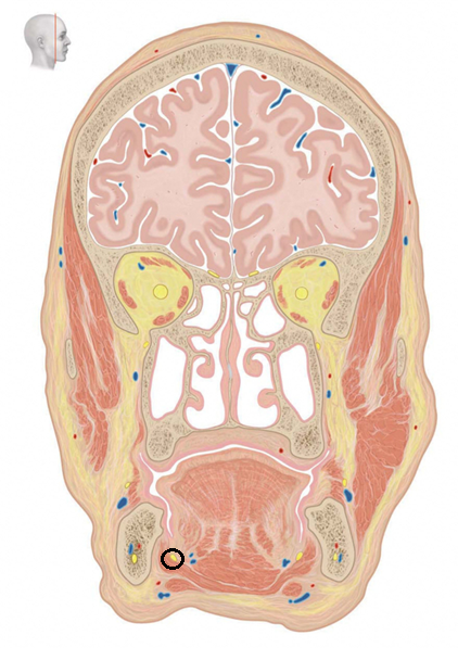 term image