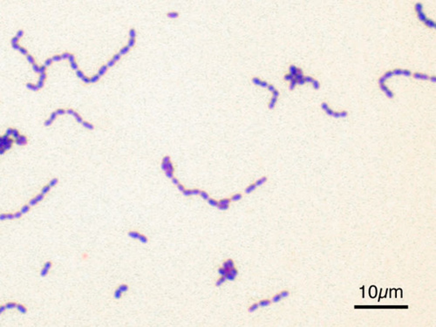 <p>GPC, catalase neg, arranged in chains, non-motile</p>