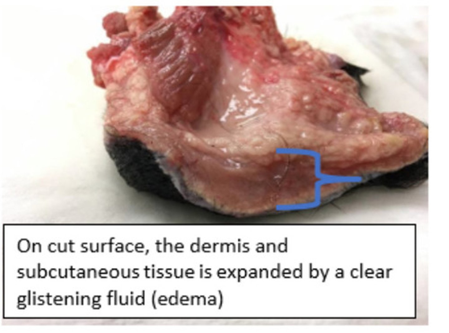 <p>What is the lesion?</p>