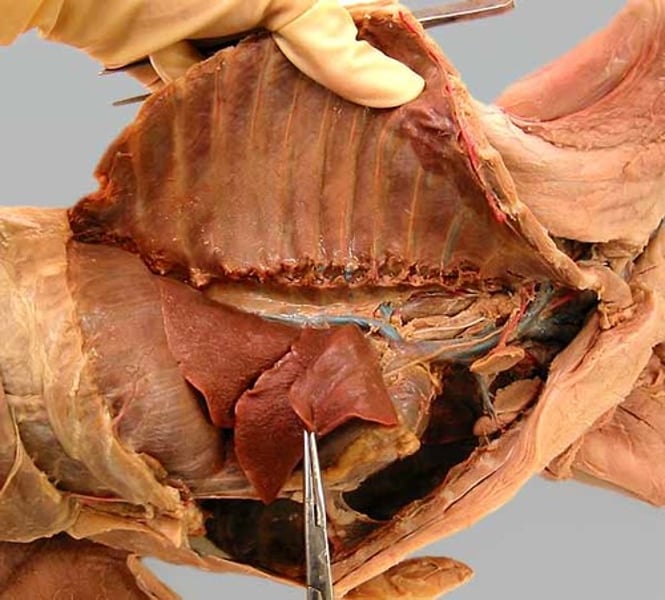 <p>contains the lungs</p>