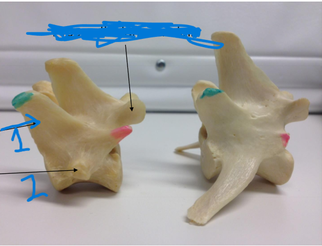 <p>Vad är det rosa och vad heter det hos Lumbales?</p>