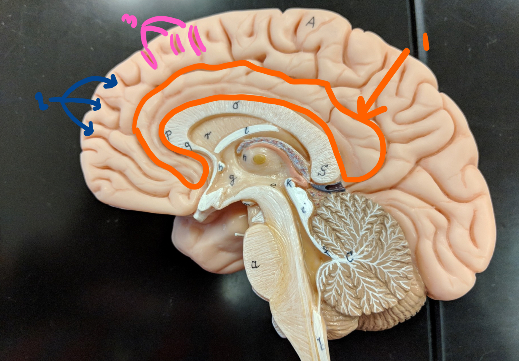 <p>what structure is at 3?</p>