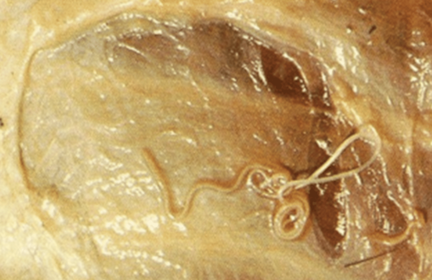 <p>what parasite is this in the subcutaneous tissue of a dog? what disease is this?</p>