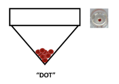 <p>Haemagglutination microplate: Dot indicates…</p>